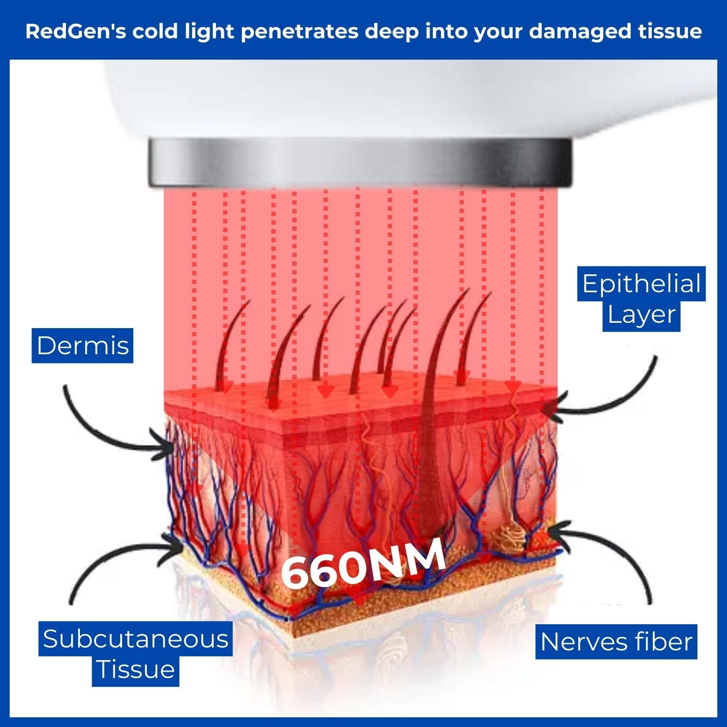 RedGen™ Treatment Laser Therapy Wand